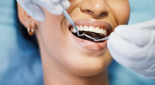 Best Dental Abscess Treatment in Oxford, AL